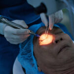 Cataract Operation Cost in Australia